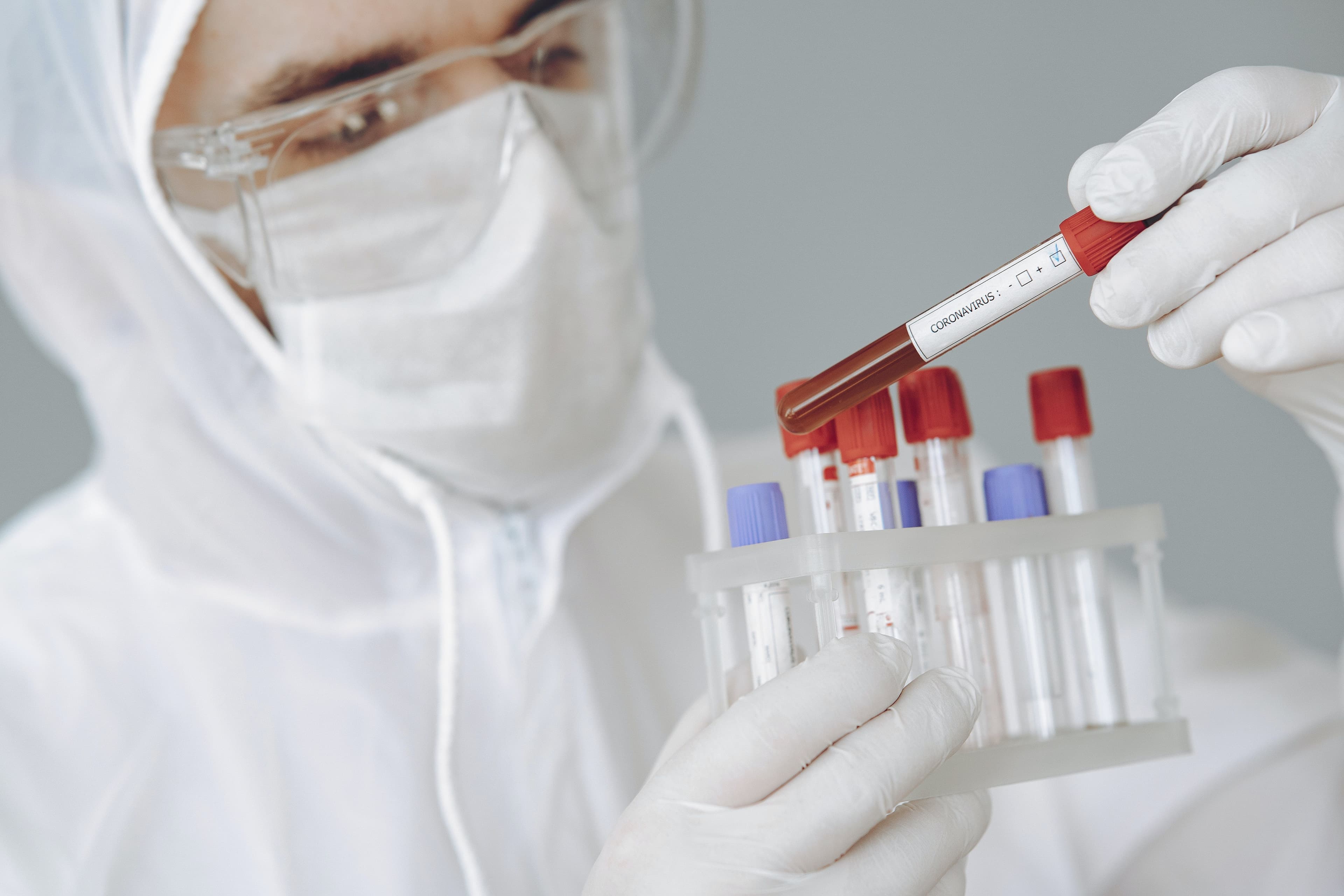 Effects of Climate Change Making Over 200 Human Pathogenic Diseases More Severe, Says Study